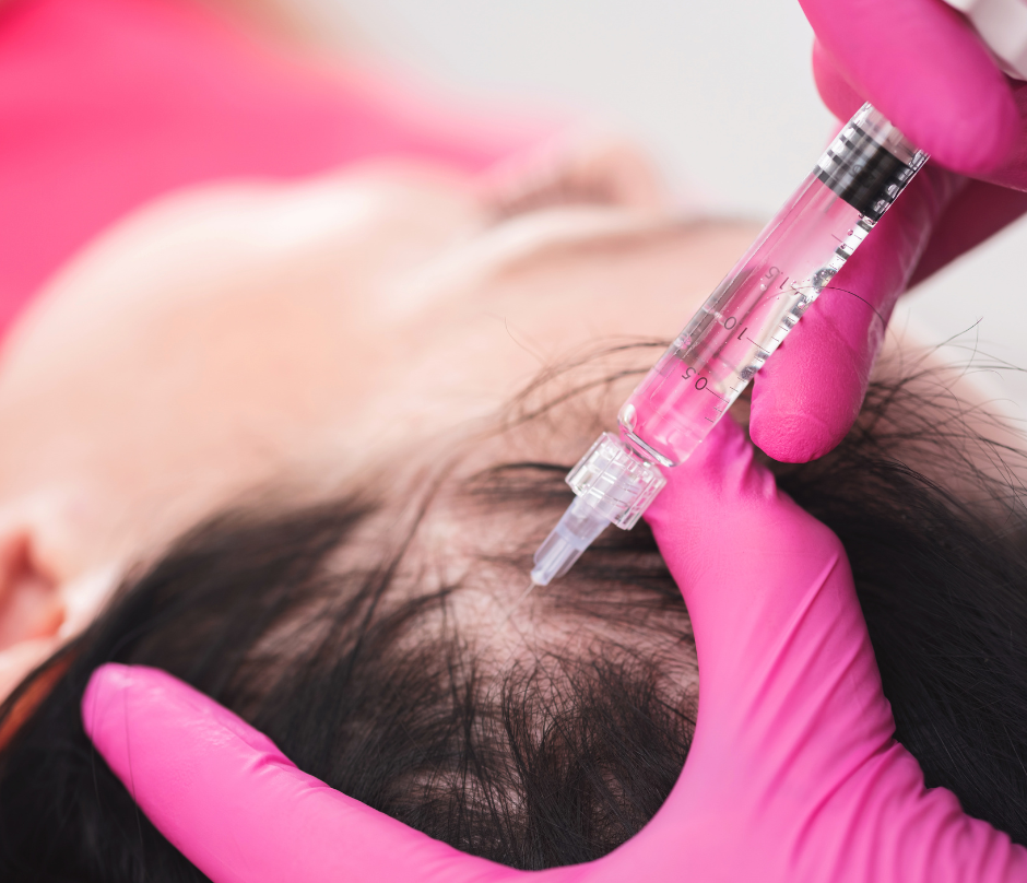 needle is injected into the scalp