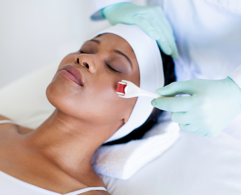 black woman having microneedling treatment