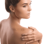 a woman with a shoulder scar
