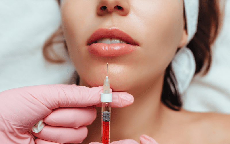 lip augmentation with fillers lip contouring