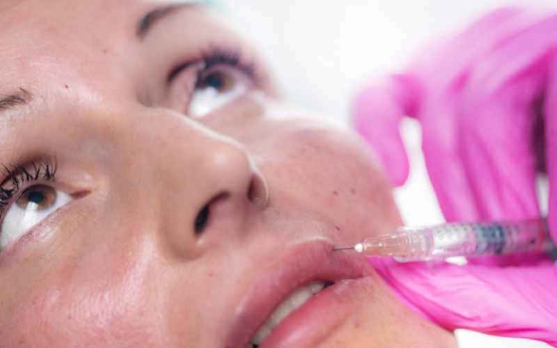 woman injected with lip filler