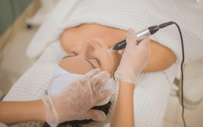 female face laser hair removal
