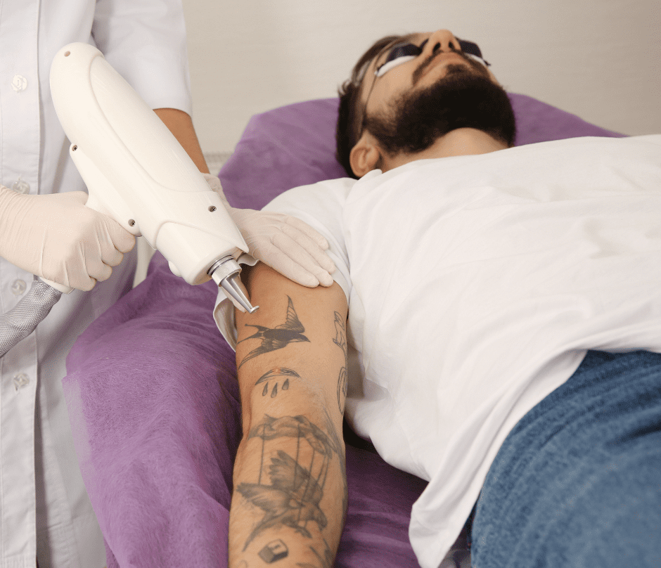 a man gets a laser tattoo removal procedure