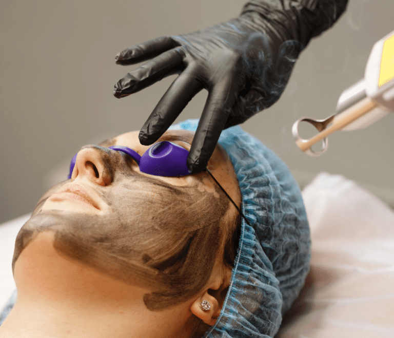 a patient undergoes hollywood laser peel