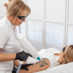 woman having laser tattoo removal procedure