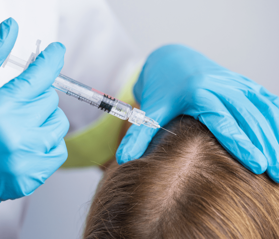 a patient's scalp is being injected by a doctor