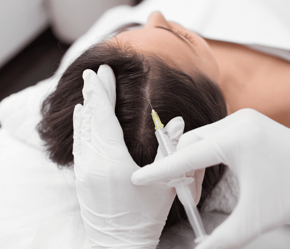 a doctor injects the patient's scalp for hair loss
