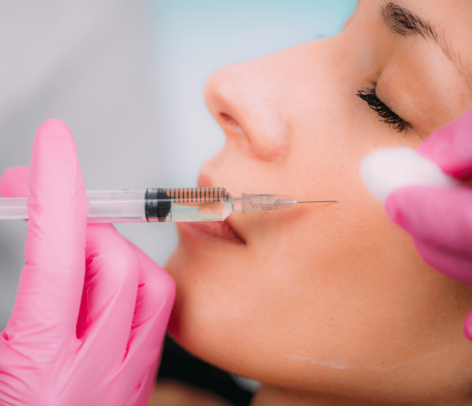 dermal fillers are injected into the patient's cheeks
