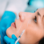 doctors hand injecting FDA-approved dermal fillers on the patient's cheeks