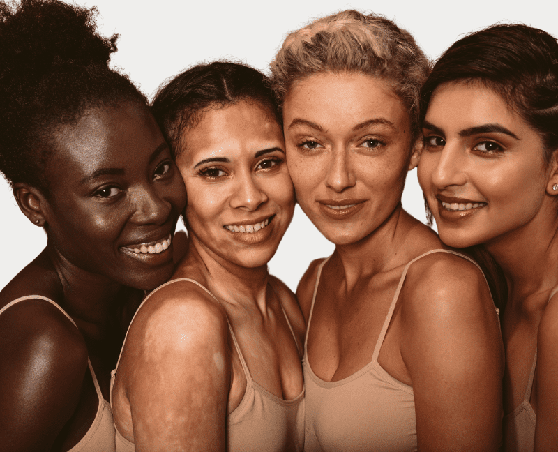 multicultural women with beautiful skin will undergo rf microneedling