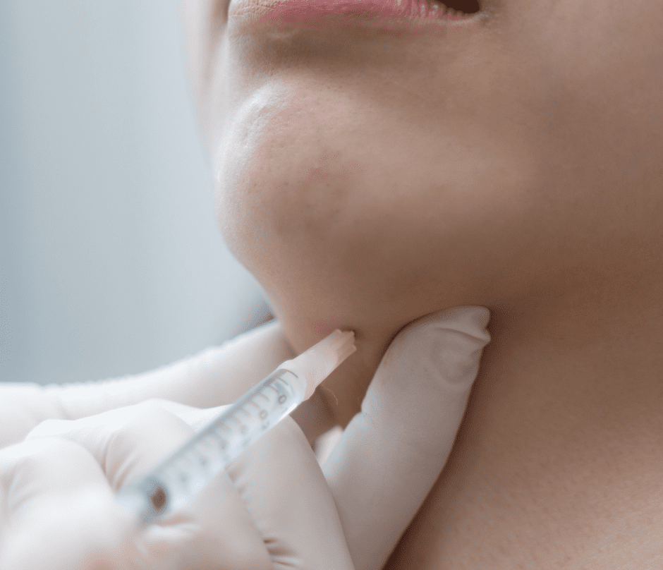kybella treatment injection on the patient's double chin