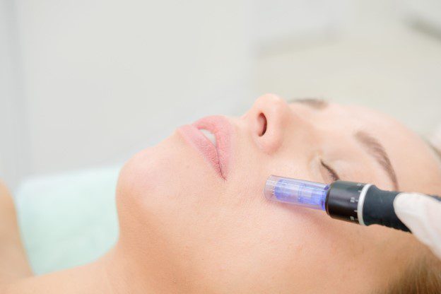 Microneedling Face