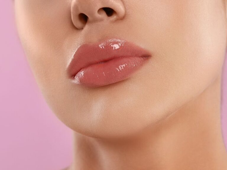 Glossy Lips with Filler