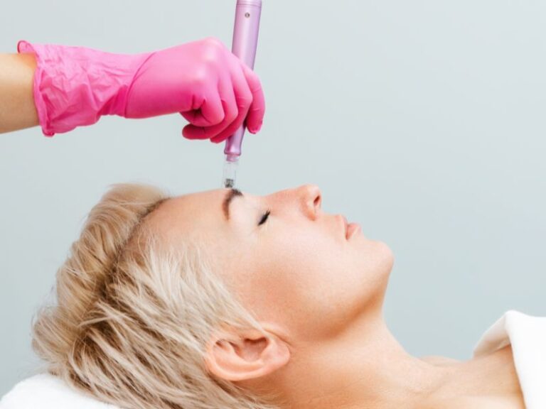 applying microneedling