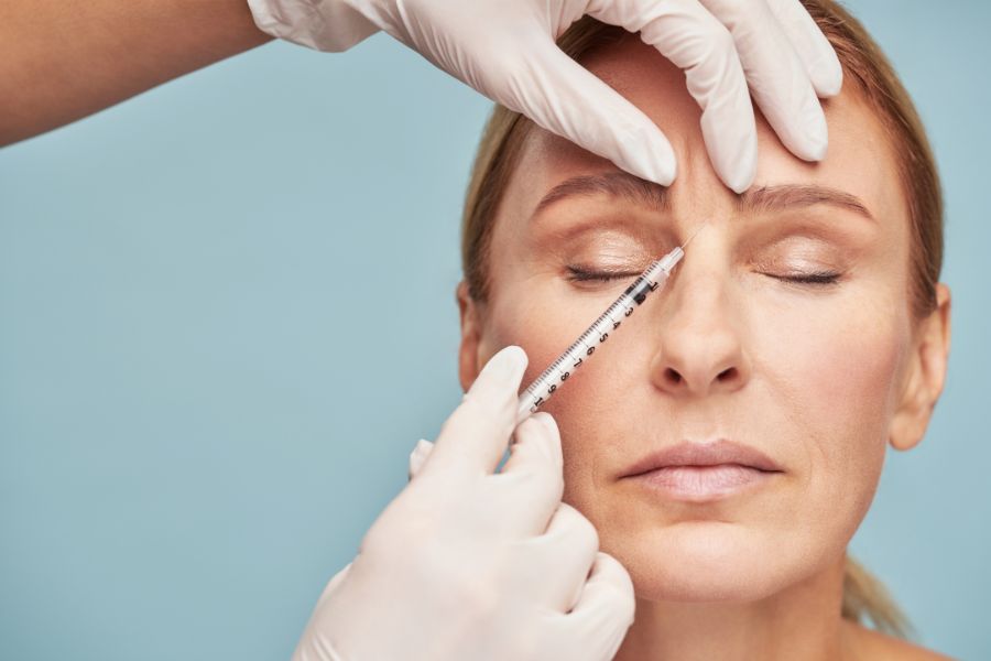 botox for glabellar lines