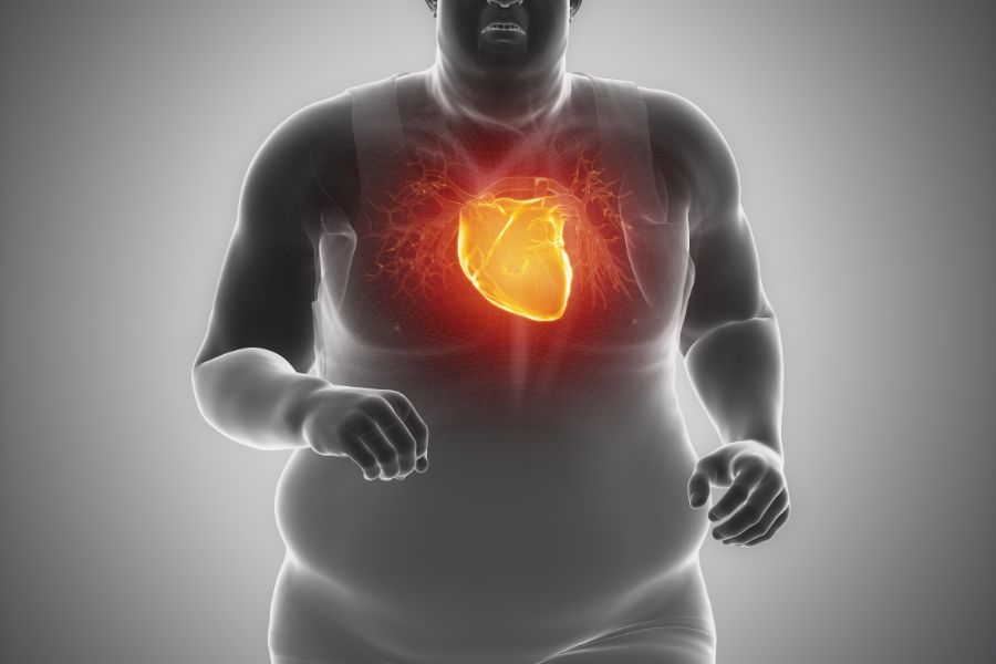 obesity affects the heart