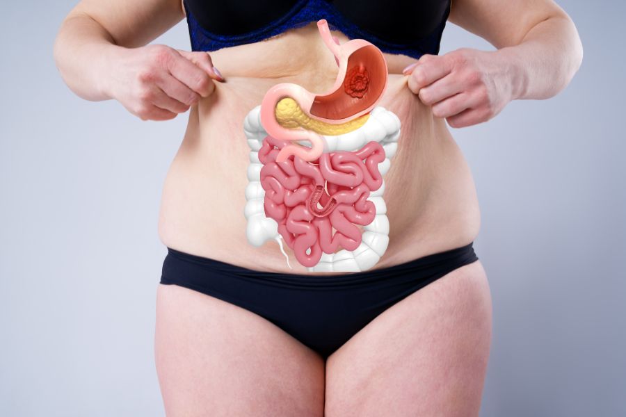 showing stomach 3d model