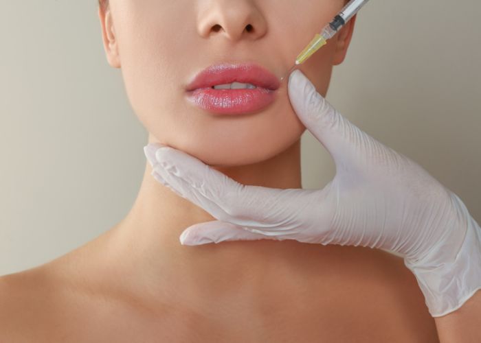 what-to-expect-in-lip-filler