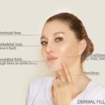 perfect derma peel for parts of the face