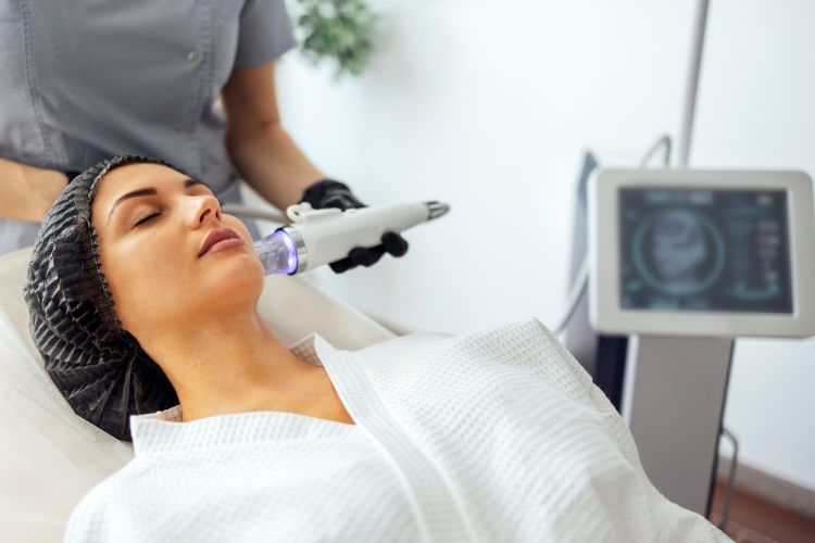 how many rf microneedling sessions for flawless skin