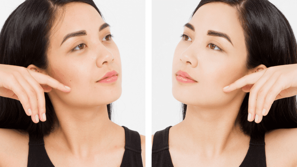 skin before and after with natural solutions