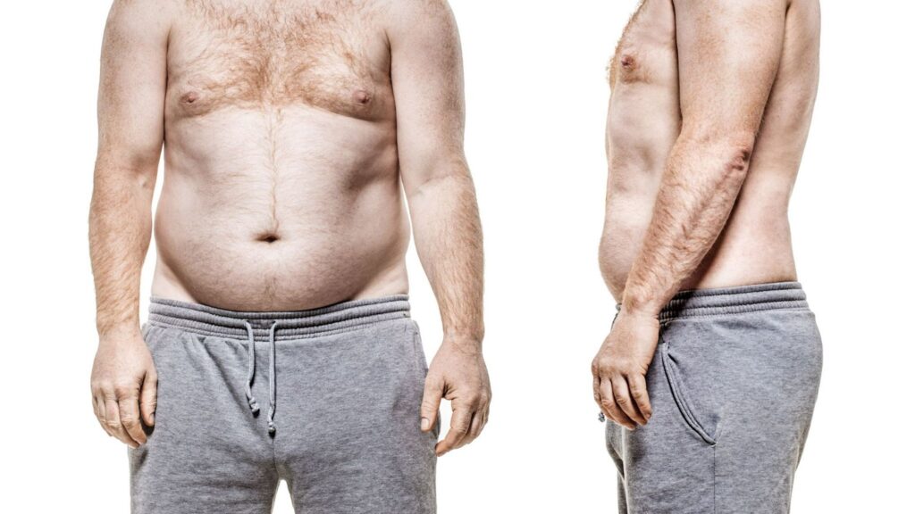 coolsculpting fat reduction for men