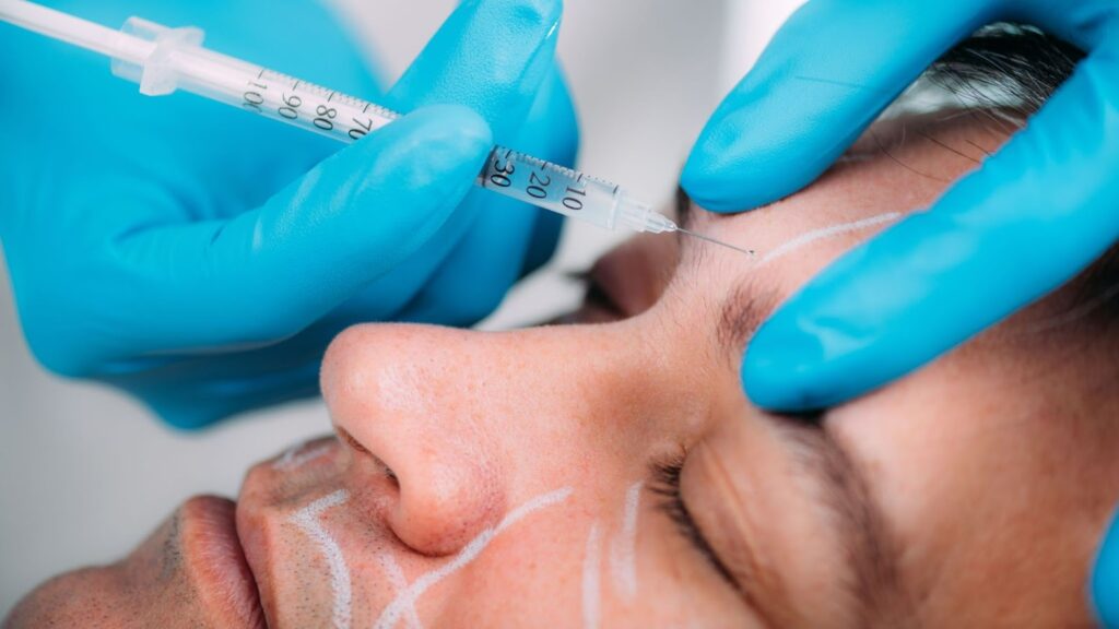 dermal fillers for men