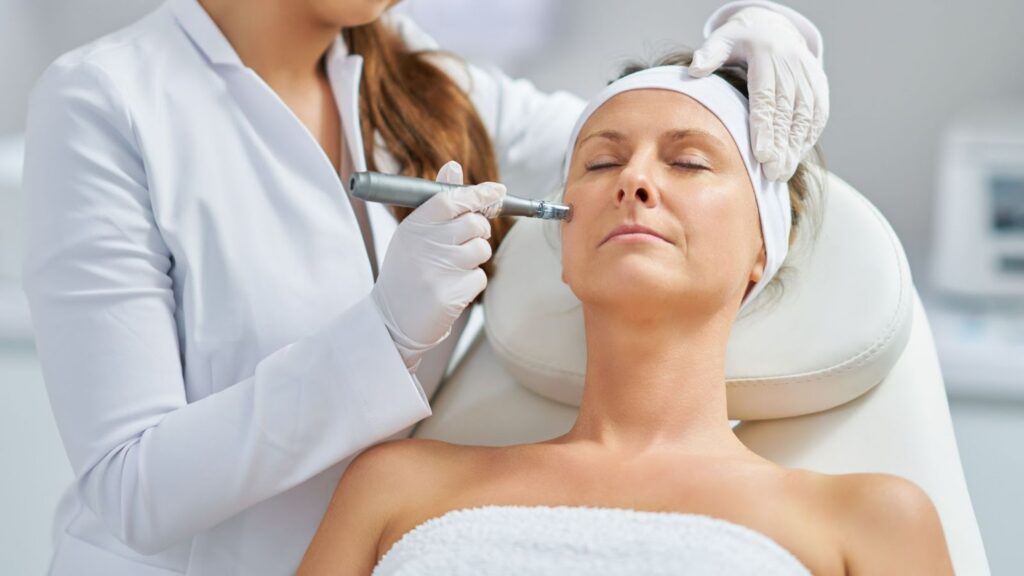 microneedling for aging skin