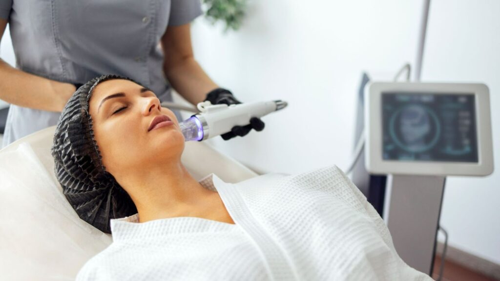 microneedling for dry skin