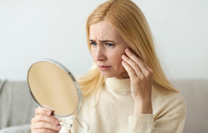 woman with wrinkles and signs of aging