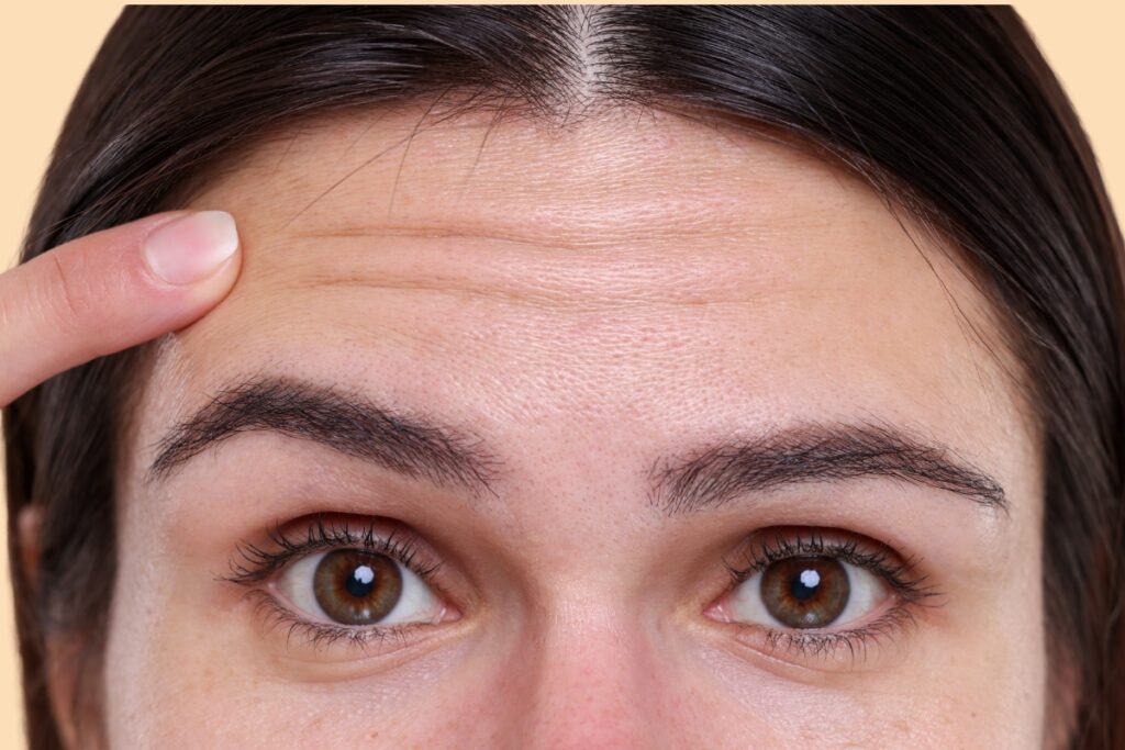 wrinkle relaxers for preventative measure used by young adults