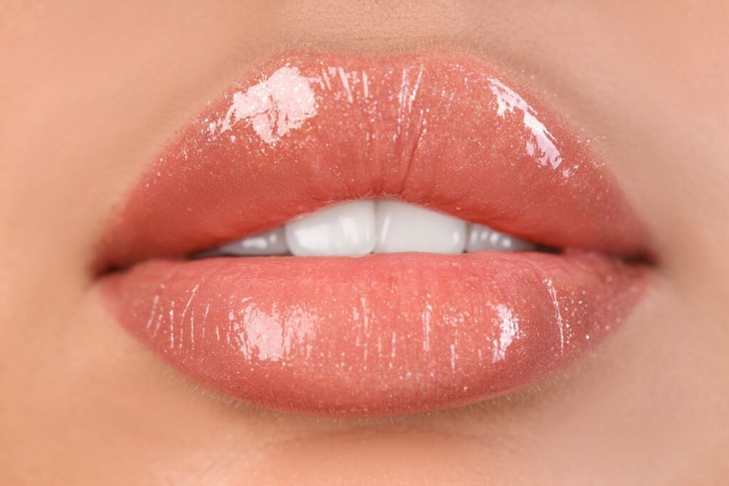 natural lip filler result