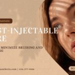 How to Minimize Bruising and Swelling