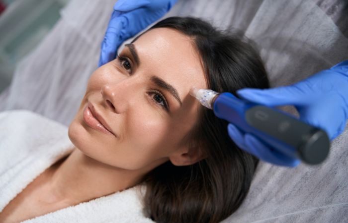 Microneedling treatment, one of the most common aesthetic treatments.
