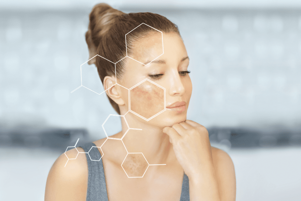 Woman with skin discoloration and molecular graphics showing why melasma keeps coming back as a chronic condition.