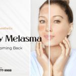Saint Aesthetix graphic with a split face comparison explaining why melasma keeps coming back and professional solutions.