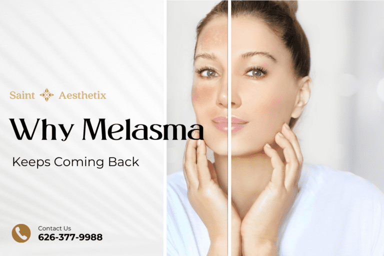 Saint Aesthetix graphic with a split face comparison explaining why melasma keeps coming back and professional solutions.