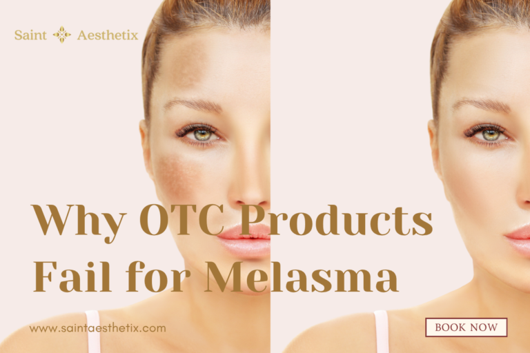 Why OTC Products Fail for Melasma Banner