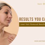 Why Laser Treatments at Saint Aesthetix Deliver More Than Surface-Level Change
