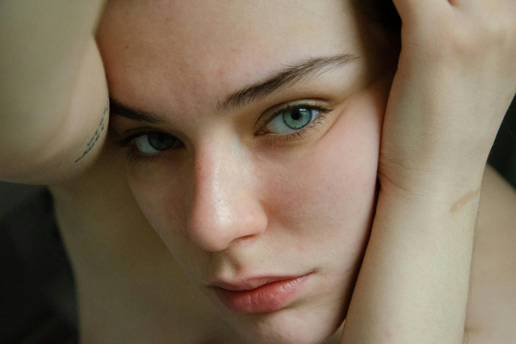 Close-up portrait of a client resting her head on her hands showing smooth facial skin and natural texture after microneedling PRP.