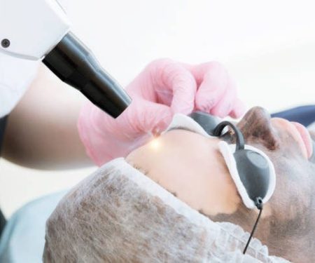 Carbon Facial 1