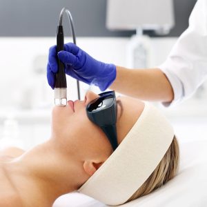 Laser treatment for the face.