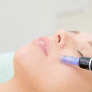 Microneedling Face