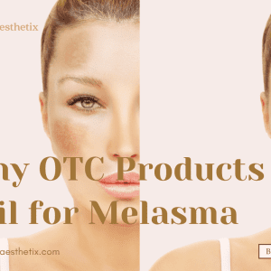 Why OTC Products Fail for Melasma Banner