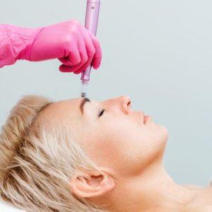 applying microneedling