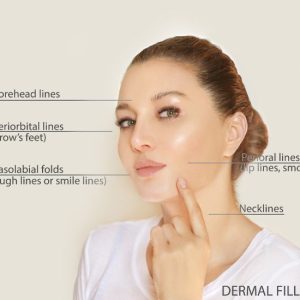 perfect derma peel for parts of the face