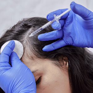 hair loss treatment