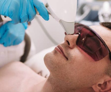 ipl photo facial