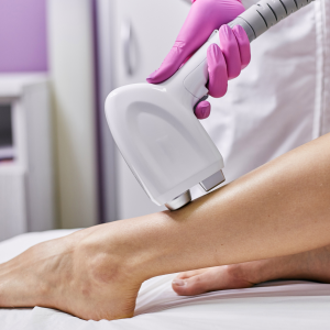 young girl on a laser hair removal session