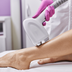 young girl on a laser hair removal session
